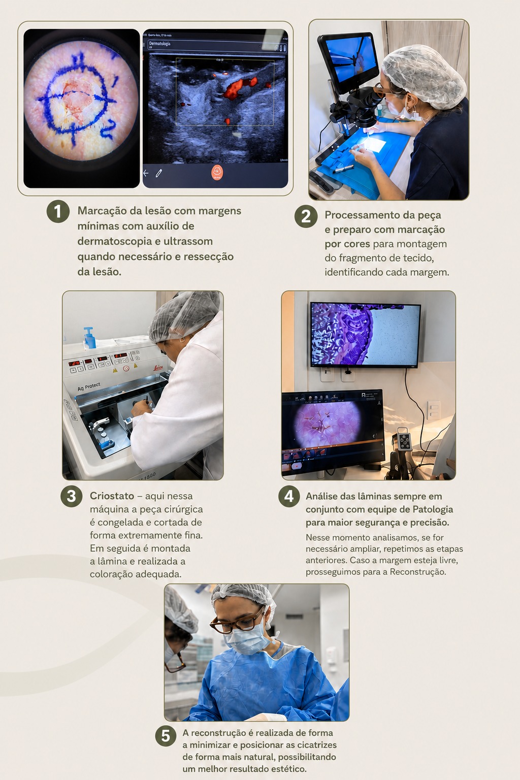 Cirurgia Micrográfica de Mohs realizada pela Dra. Luciana Borsoi